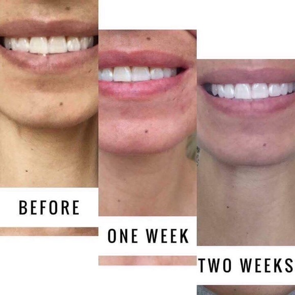 Whitening Toothpaste - Picture 2 of 2