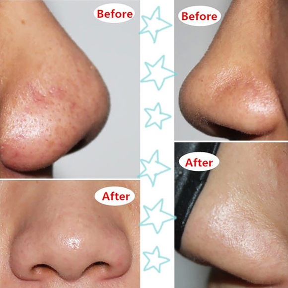 Black Mask - Picture 2 of 6