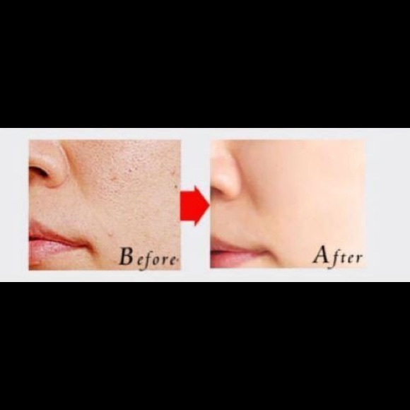 Black Mask - Picture 3 of 6