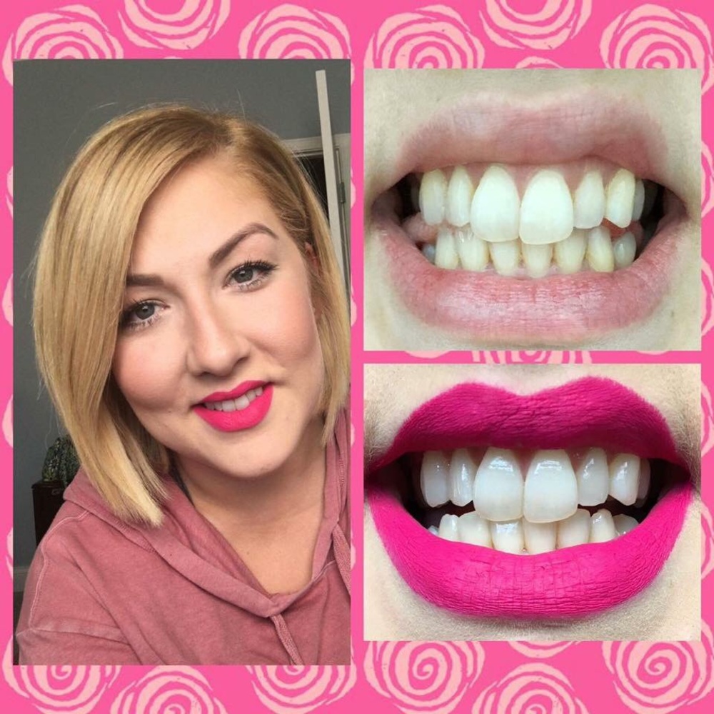 Whitening Tooth Paste