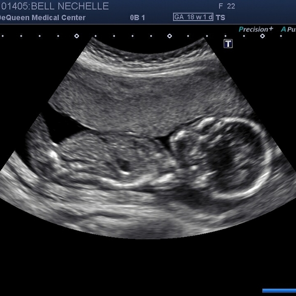 Meet your Posher, Nechelle - Picture 1 of 1