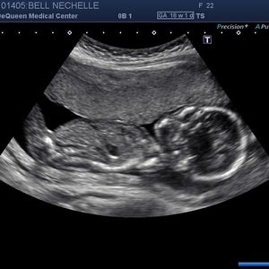 Meet your Posher, Nechelle