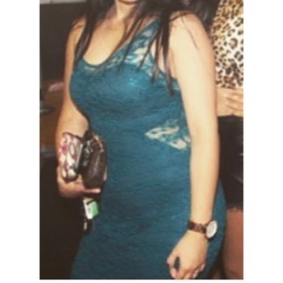 Green Lace Skin Tight Dress - Picture 5 of 5