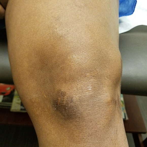 Meet your Posher, Ultra - Picture 1 of 1