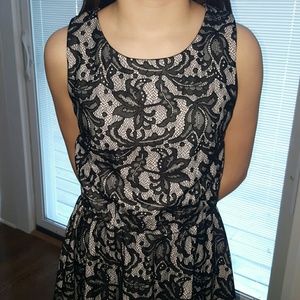 Dresses - Lace overlay dress Dresses - Lace overlay dress