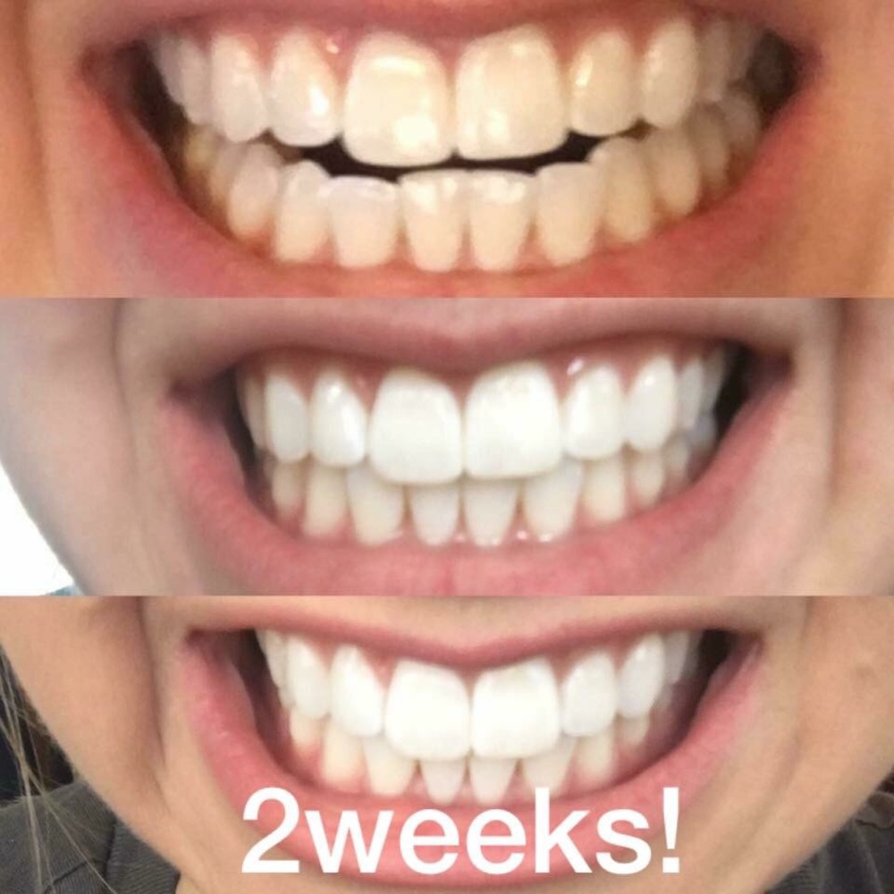 Whitening Fluoride Toothpaste! - Picture 2 of 4