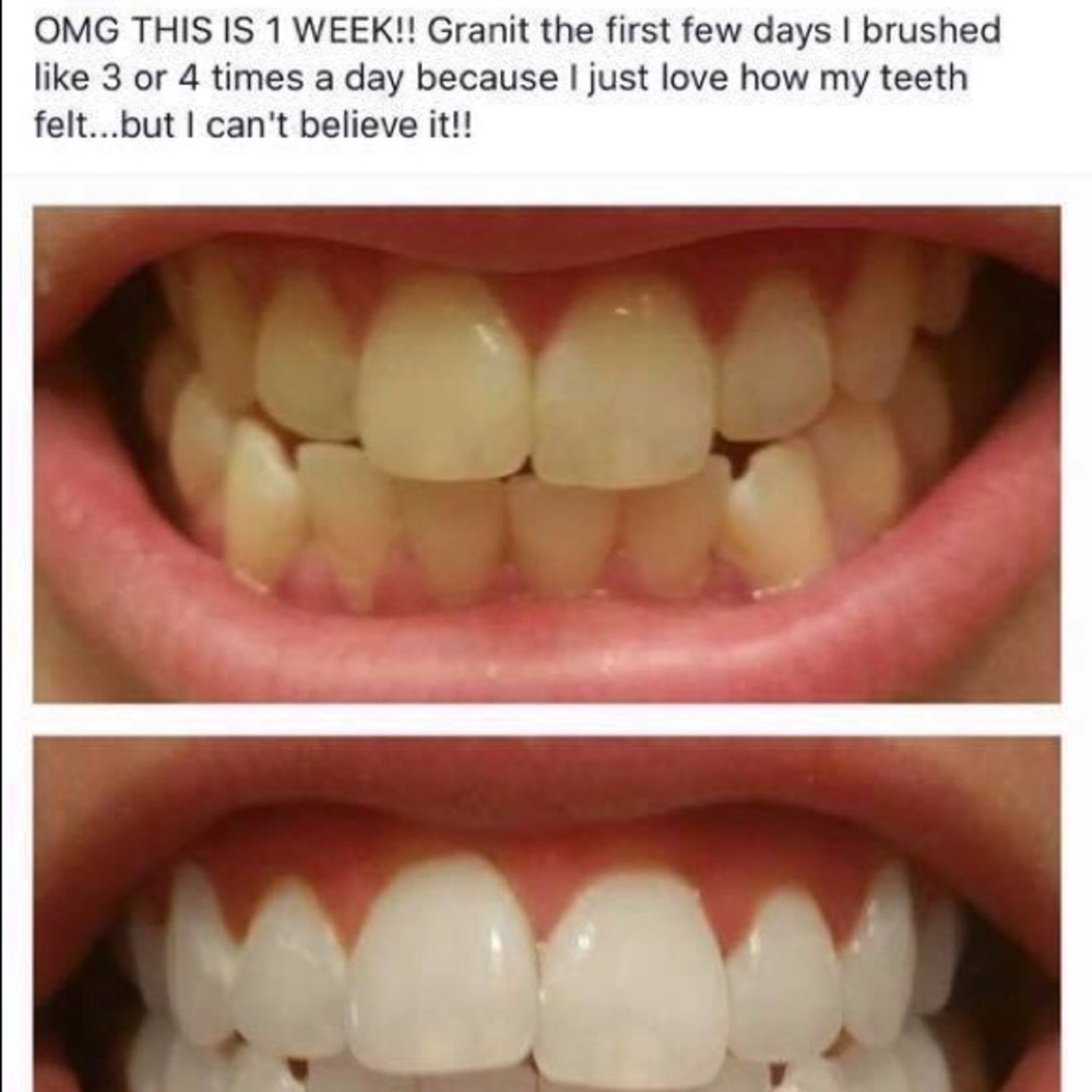 Whitening Fluoride Toothpaste! - Picture 3 of 4