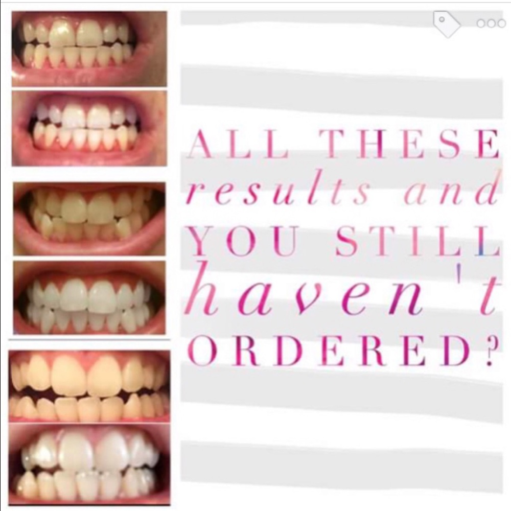 Whitening Fluoride Toothpaste! - Picture 4 of 4