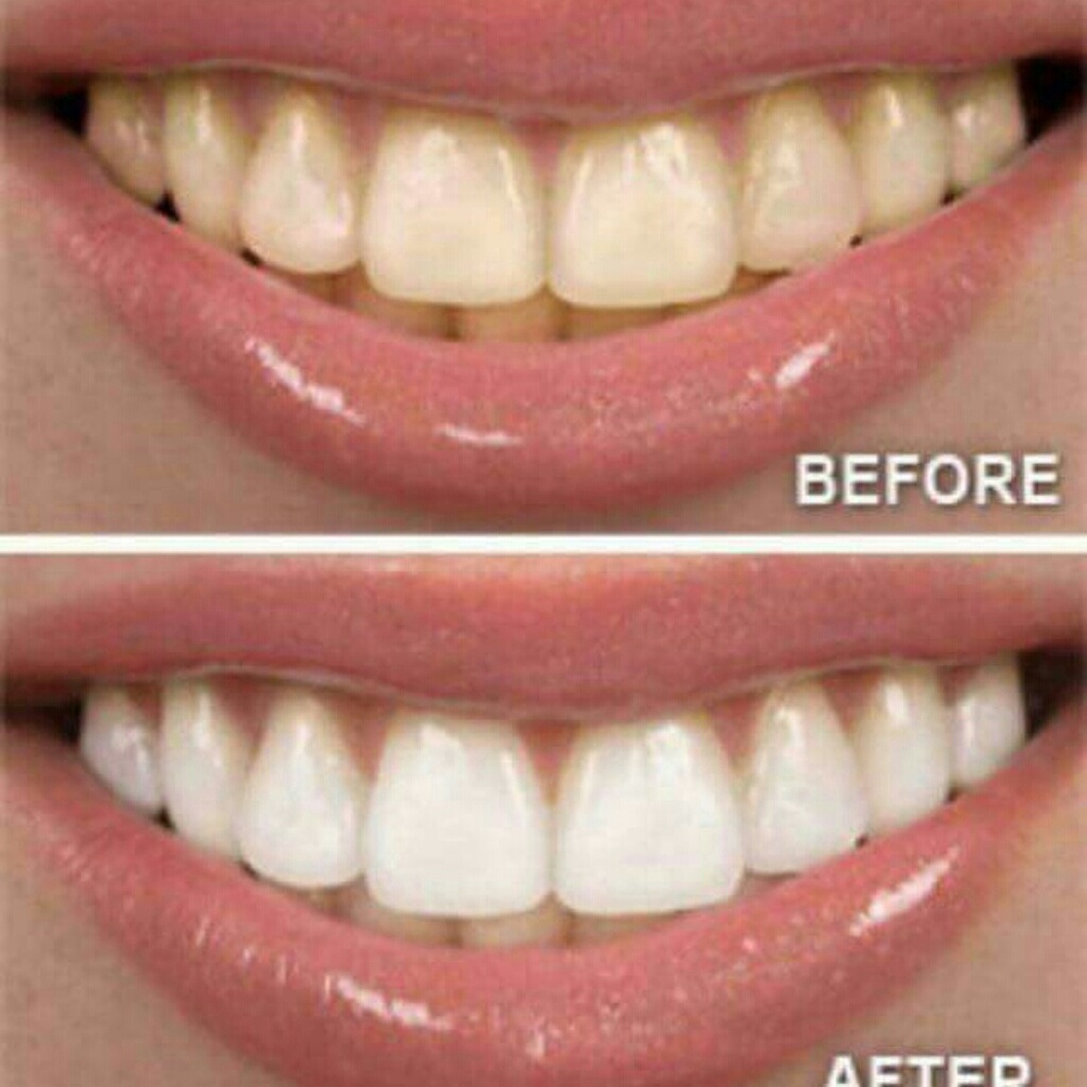 💎Professional AP24 Whitening Toothpaste💎