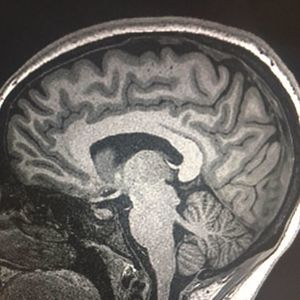 Meet your Posher, Gracie