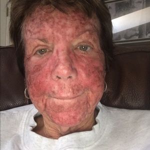 Meet your Posher, Patty