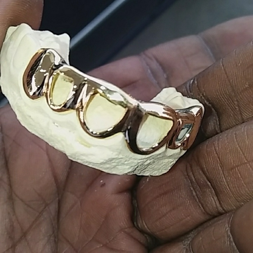 6pc 8 karat Yellow Gold Grill