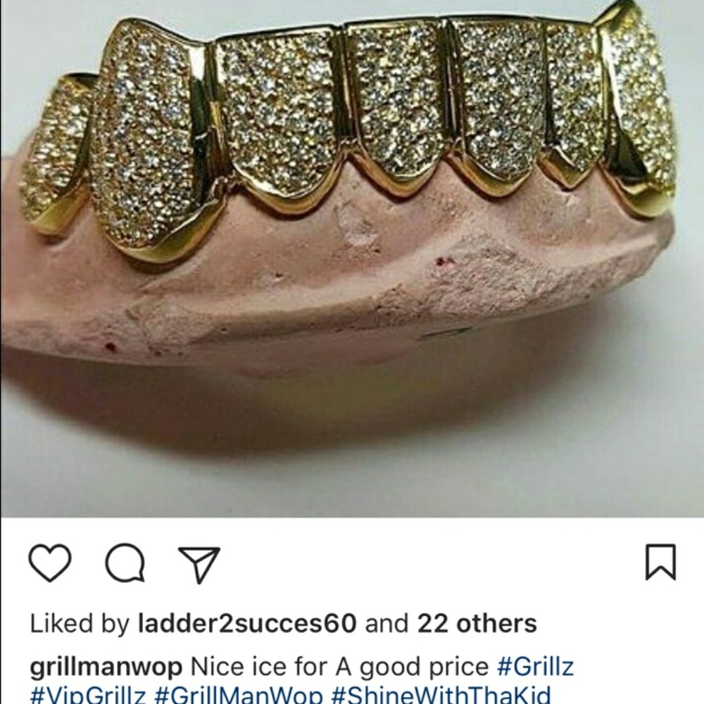 Gold Grillz