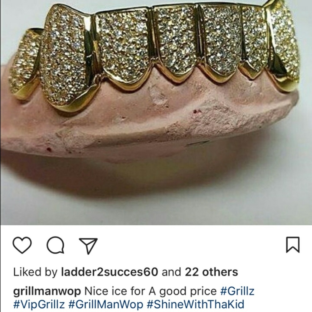 Gold grillz