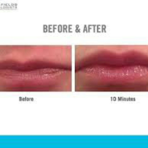 Lip renewing serum - Picture 4 of 4