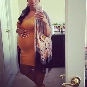 Mustard yellow mini dress