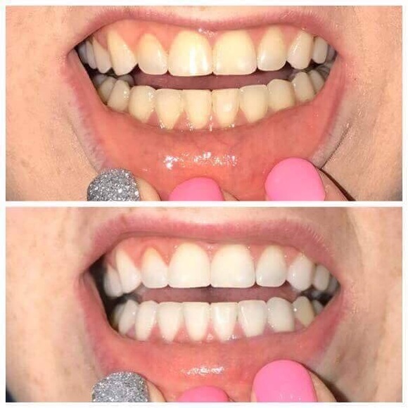 🎈SOLD🎈AP24 - Picture 2 of 4