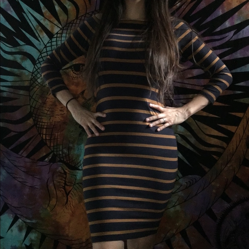STRIPED FOREVER 21 DRESS 👗