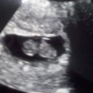 Meet your Posher, Lucy