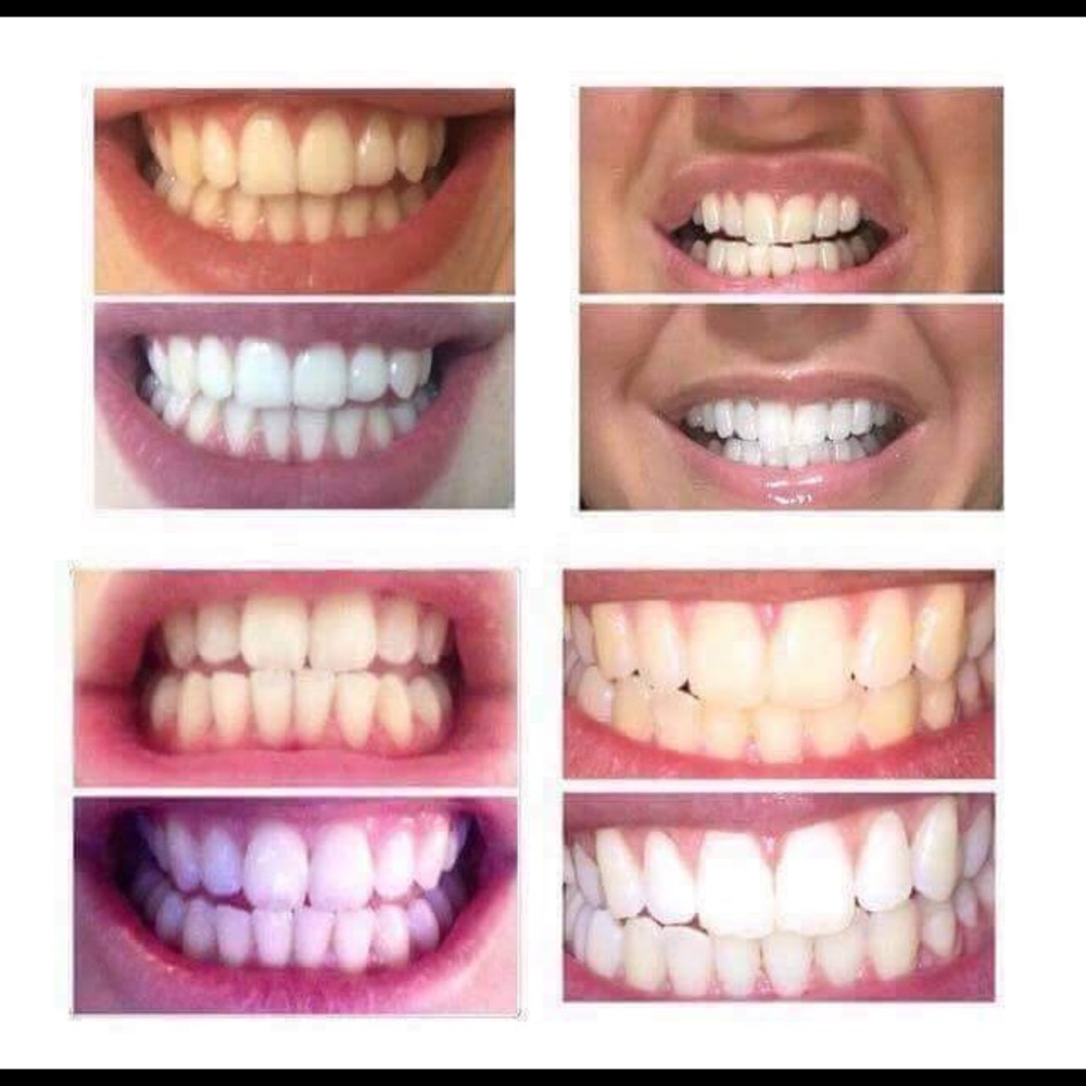 AP-24 WHITENING 😁 Toothpaste Brand New & Sealed!