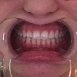 Meet your Posher, Karlye