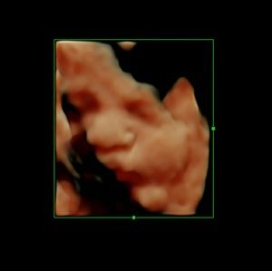 Meet your Posher, Bianca