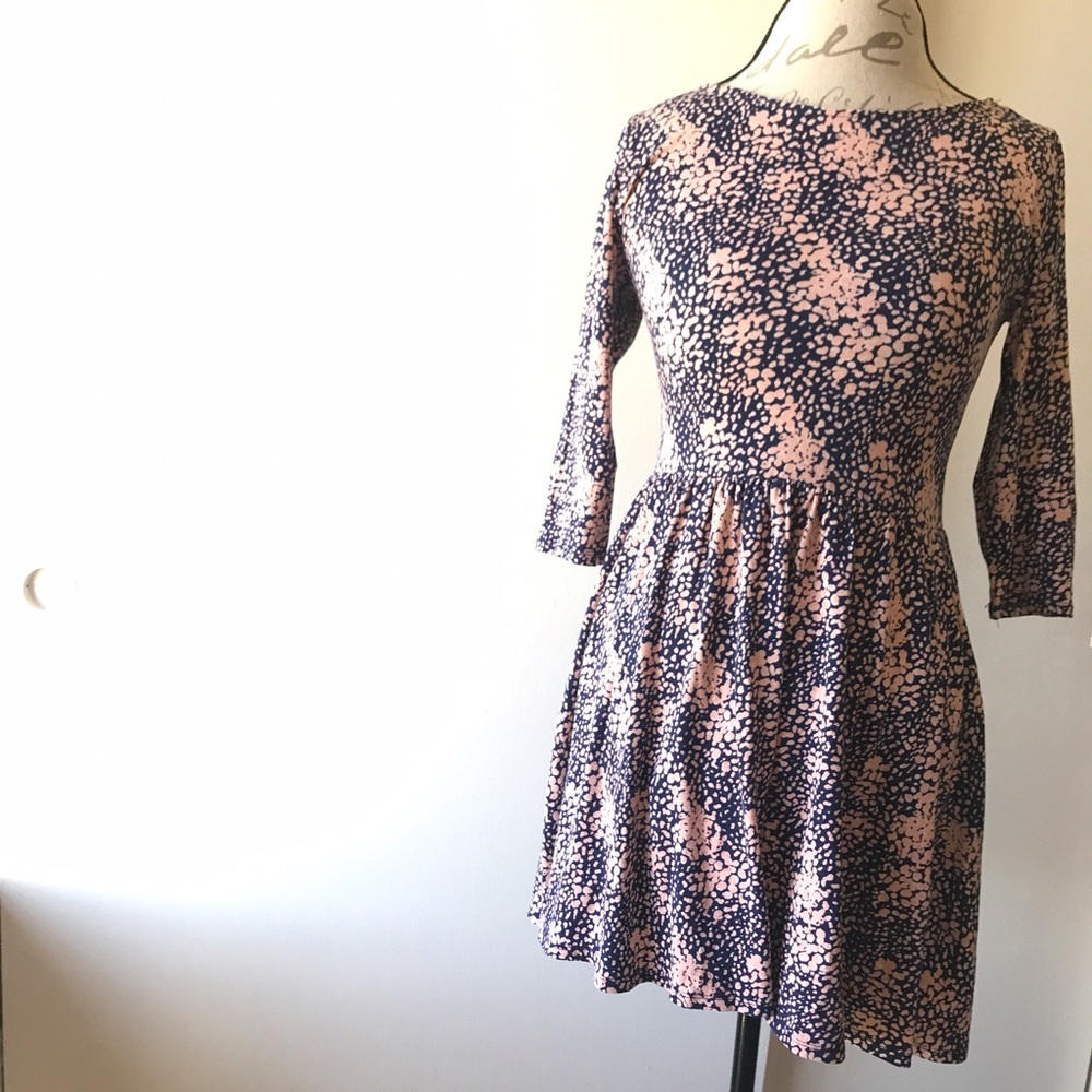 Forever 21 Casual Dress