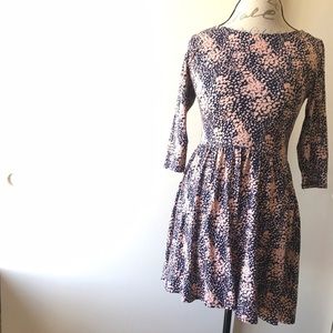 Forever 21 Casual Dress