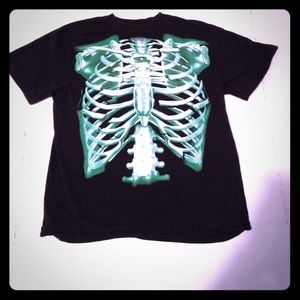 Broken bone shirt