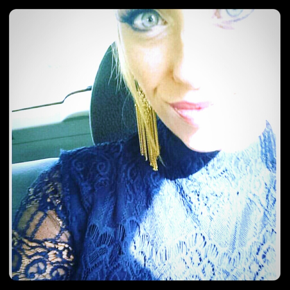 Lace Detail Dress ✨