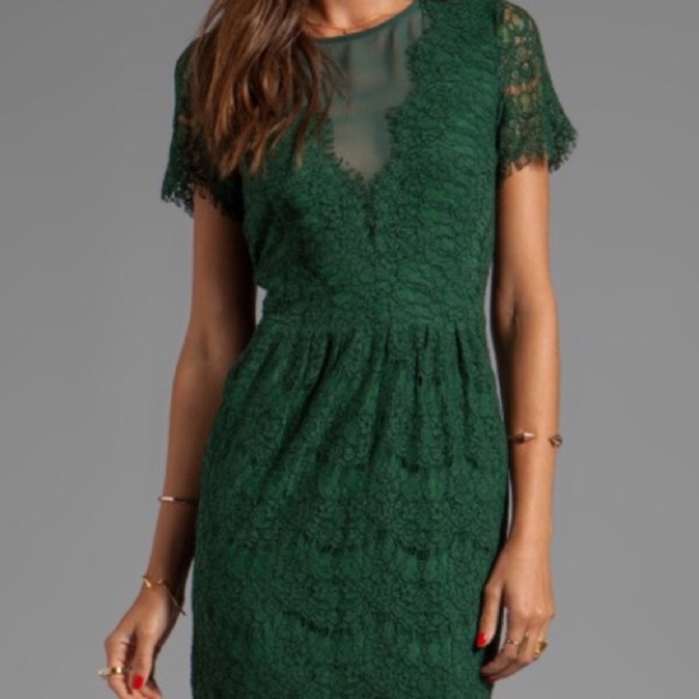 Dolce Vita green lace open back dress