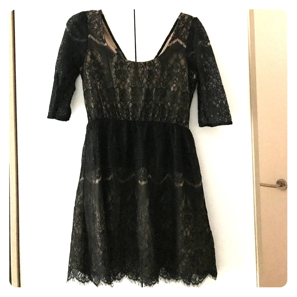 Scalloped Lace Dress