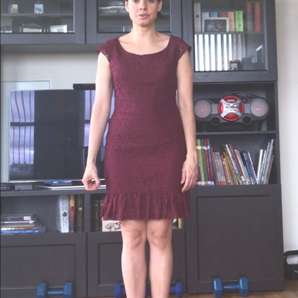 Aritzia Lace Dress - Never Worn