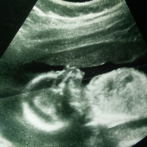 Meet your Posher, Tikisha