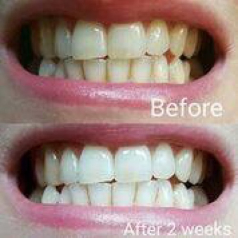 *Whitening Toothpaste 💋❤️💋