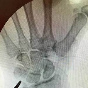 Meet your Posher, Caryl