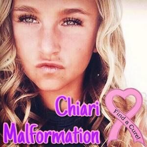 Meet your Posher, Alisa