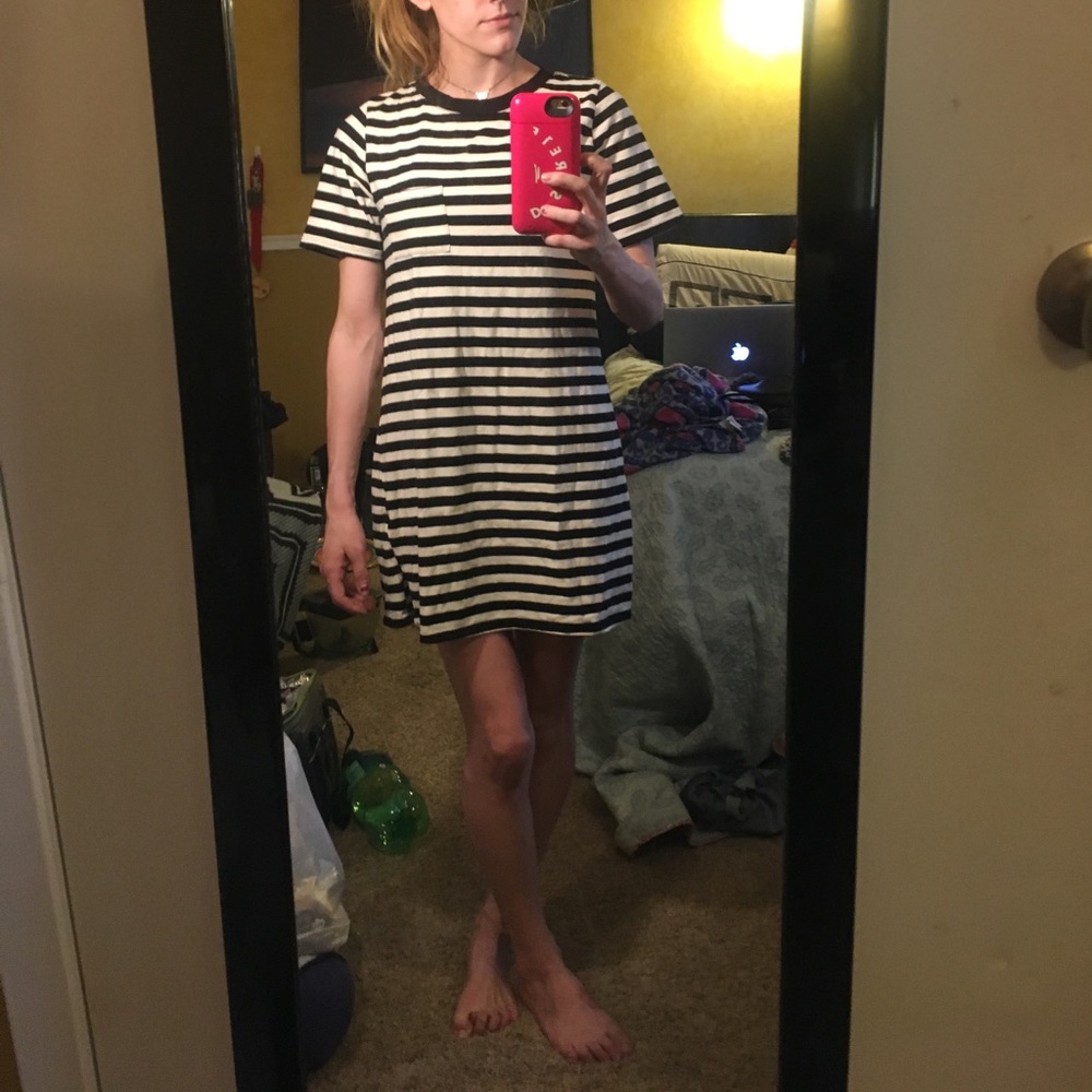 Cap sleeve black and white striped dress