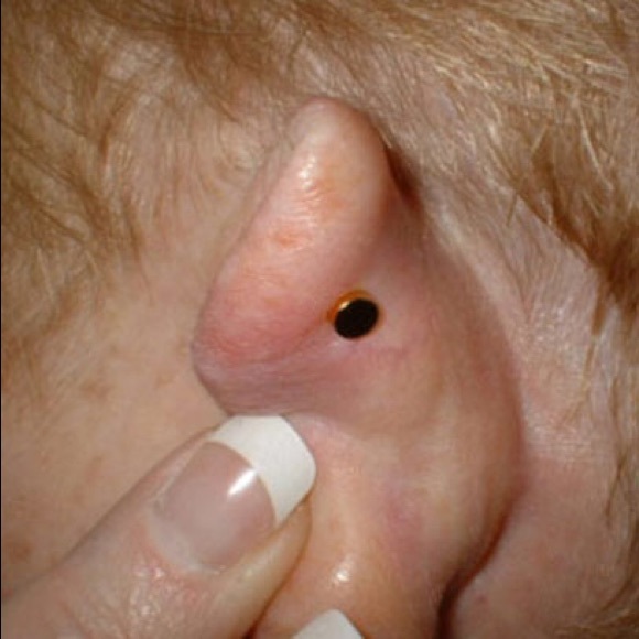 Stress Relief Blue Earring Magnet Acupressure Stress Relief - Picture 2 of 4