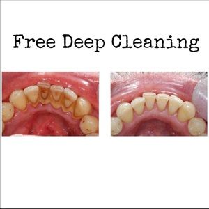 FREE Deep Dental Cleaning in Inland Empire 👄