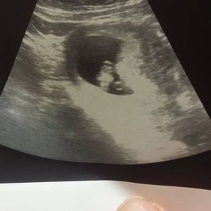 Meet your Posher, Arnie