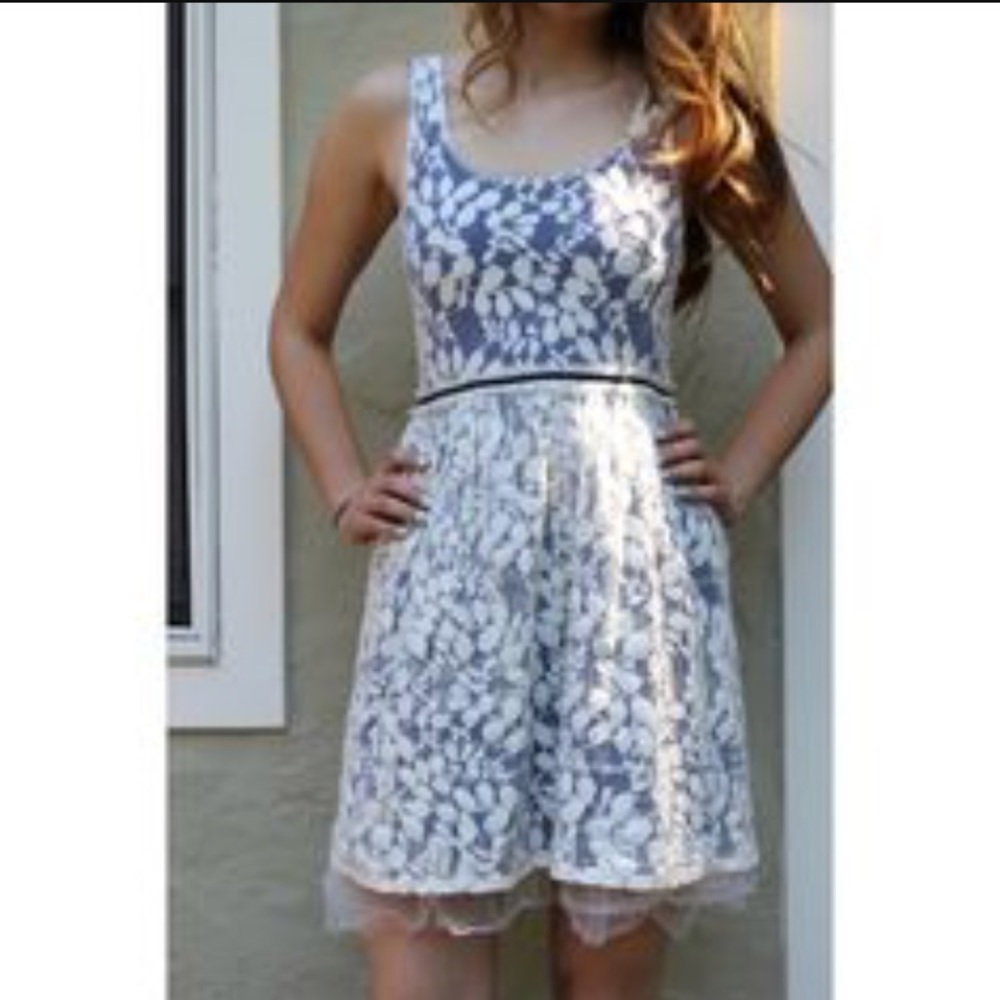 Anthropologie lace dress