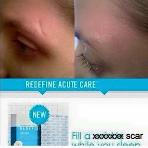 Rodan and Fields Acute Care