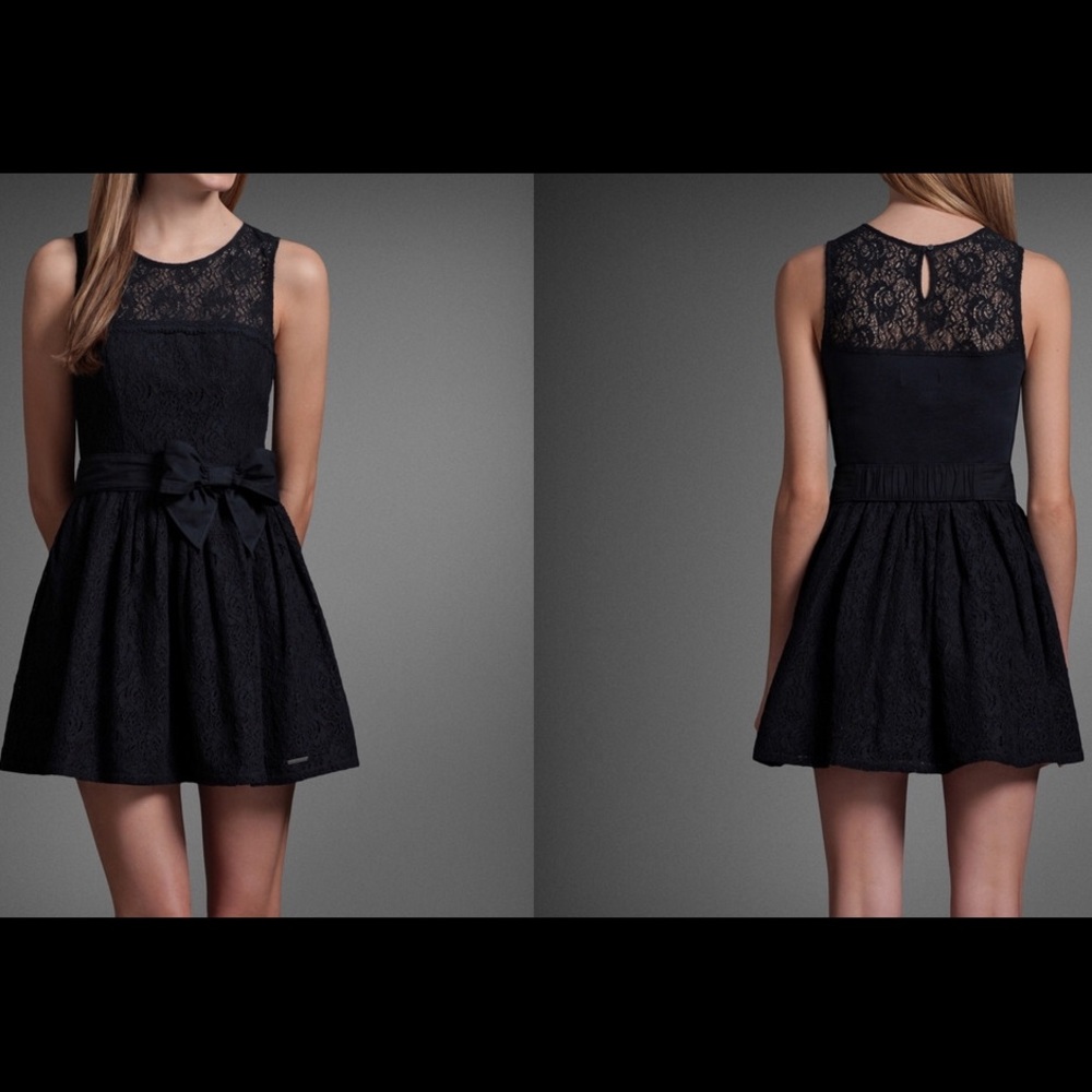 Abercrombie & Fitch Summer lace dress