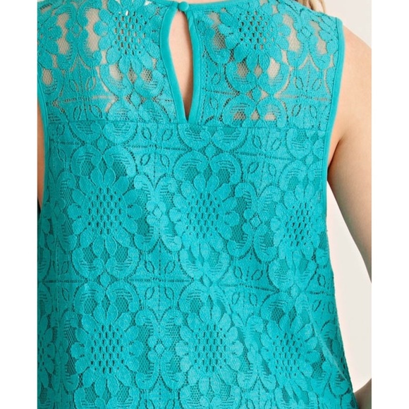🆕 Sleeveless Teal Lace Dress - Picture 4 of 5