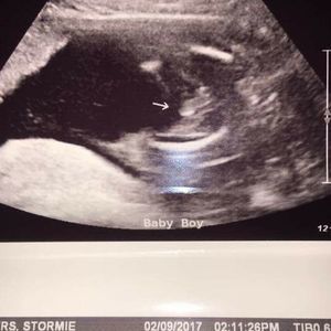 Meet your Posher, Loretta