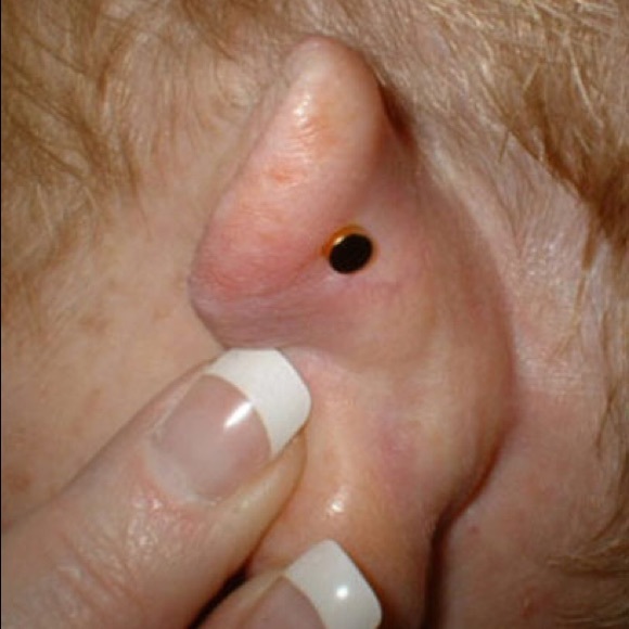 Stress Relief Green Earring Magnet Acupressure - Picture 2 of 4