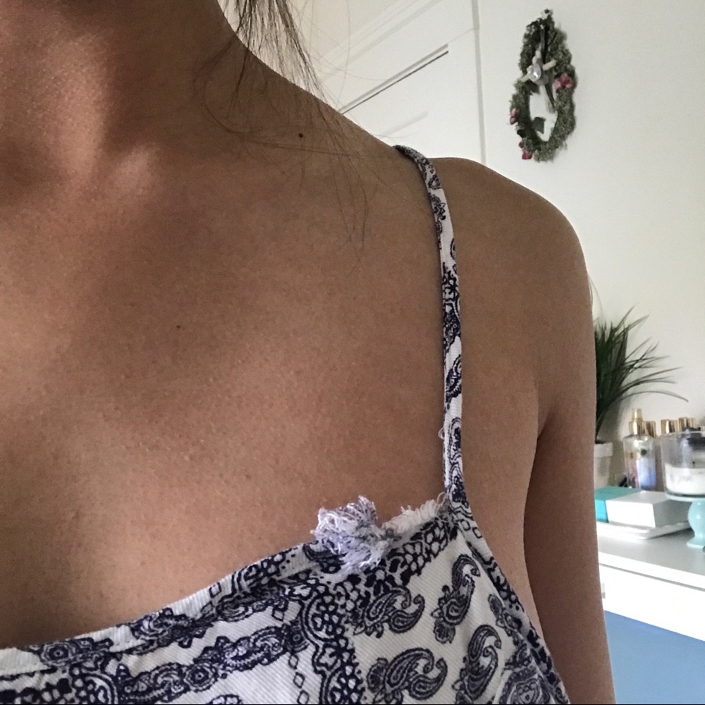Backless Romper - Picture 3 of 3