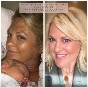 RODAN + FIELDS REVERSE REGIMEN