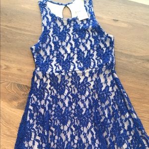 Nude and blue lace skater dress